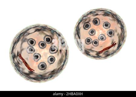 Kystes de protozoaires d'Entamoeba coli, illustration informatique.E. coli est un amibe non pathogène, son kyste est de 15-25 micromètres, possède huit noyaux et une barre chromatoïdale allongée avec des extrémités fracturées (rouge foncé). Banque D'Images