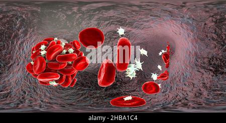 Caillot de sang composé de globules rouges, de plaquettes et de brins de protéines de fibrine.Vue panoramique VR à 360 degrés, illustration. Banque D'Images