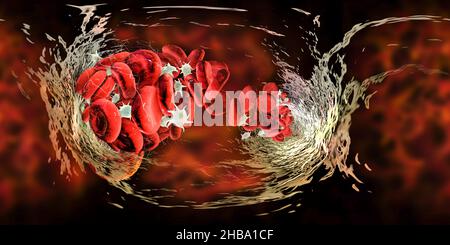 Caillot de sang composé de globules rouges, de plaquettes et de brins de protéines de fibrine.Vue panoramique VR à 360 degrés, illustration. Banque D'Images
