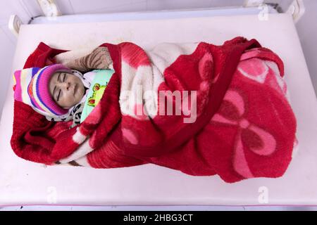 Indira Gandhi l'hôpital pour enfants de Kaboul est un hôpital pour enfants d'Afghanistan. Les enfants de moins de 5 ans qui souffrent de malnutrition sont hospitalisés. Banque D'Images