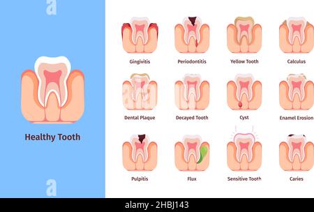 Problèmes de dents.Illustrations d'infographie médicale avec étiquette dentaire de Bad commons bactéries orales et méthodes de prévention garish images vectorielles Illustration de Vecteur
