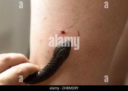 Morsure de serpent venimeux dans la jambe de l'homme, gros plan. Banque D'Images