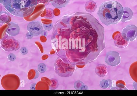 Leucémie lymphoblastique aiguë (TOUTES) cellules cancéreuses dans le flux sanguin - vue rapprochée 3D illustration Banque D'Images