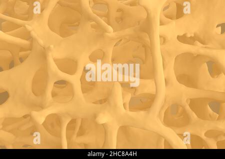 Fractures osseuses dans l'ostéoporose - matériau naturel vue avant 3D illustration Banque D'Images