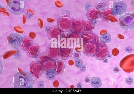 Leucémie lymphoblastique aiguë (TOUS) groupes de cellules cancéreuses dans le flux sanguin - vue isométrique 3D illustration Banque D'Images