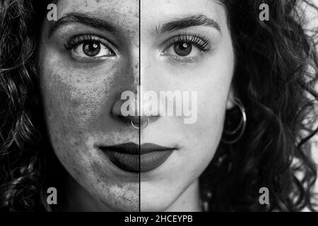 Avant et après un gros plan d'une peau qui a besoin de soins après une longue exposition aux rayons uva uvb ou qui a besoin de revitalisation en raison des endroits locaux Banque D'Images