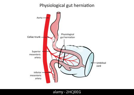 Hernie intestinale physiologique, développement du tractus gastro-intestinal (alimentaire). Banque D'Images