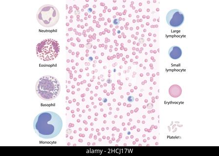 Illustration du frottis sanguin montrant la plupart des cellules, y compris les basophiles. Banque D'Images