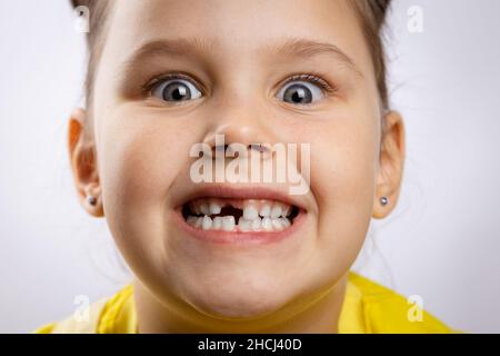 Gros plan d'une femme super excitée avec une bouche ouverte montrant une dent de bébé avant manquante et des yeux renflés sur fond blanc.Changement des premières dents Banque D'Images