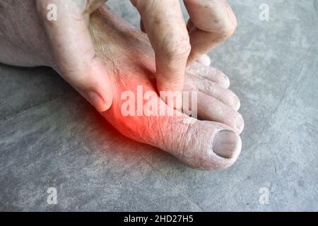 Inflammation du pied du vieil homme asiatique.Concept de douleur articulaire de pied, arthrite, trébuchement, hyperuricema ou goutte. Banque D'Images