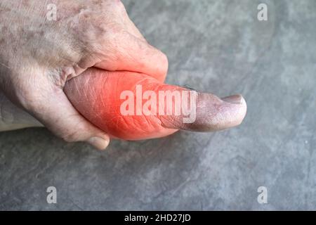 Inflammation du pied du vieil homme asiatique.Concept de douleur articulaire de pied, arthrite, trébuchement, hyperuricema ou goutte. Banque D'Images