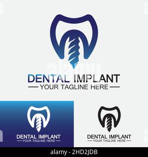 Concept de conception de vecteur de logo d'implant dentaire , modèle de logo Dental Clinic & Care Illustration de Vecteur