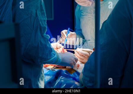 Processus d'incision des organes internes du patient à l'aide d'un électrocoagulateur pendant la chirurgie.Attention sélective aux mains des chirurgiens. Banque D'Images