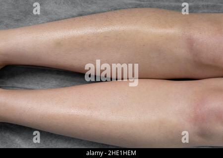 Image avant et après concept de l'épilation sur les jambes des femmes dans un salon de beauté.Gros plan Banque D'Images