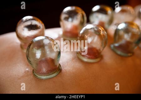 Une jeune femme se détend dans un salon de massage. Tasses à vide de thérapie de cupping médicale sur le dos de la femme, gros plan, médecine traditionnelle chinoise. Banque D'Images