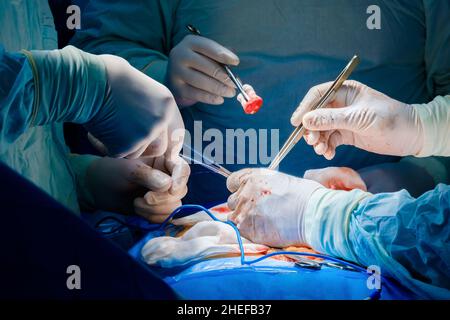 Plusieurs paires de mains de chirurgiens professionnels effectuent une chirurgie abdominale sur un patient.Mise au point sélective.Instruments chirurgicaux dans les mains des médecins pendant une opération chirurgicale. Banque D'Images