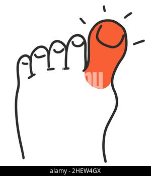 Douleur et rougeur au gros orteil avec goutte. Symptôme maladie Illustration du vecteur Doodle. Illustration de Vecteur