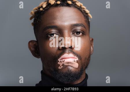 portrait de l'homme afro-américain avec une peau de vitiligo et une coiffure à la mode isolée sur le gris Banque D'Images