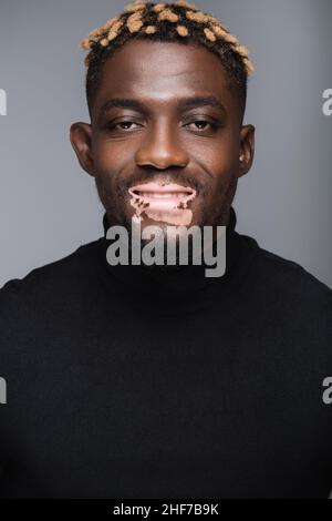 souriant africain américain homme avec le vitiligo et la coiffure élégante regardant l'appareil photo isolé sur gris Banque D'Images