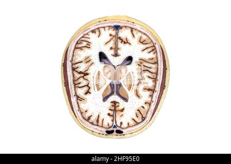 Cerveau humain, illustration Banque D'Images