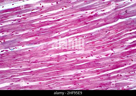 Muscle cardiaque, micrographe léger Banque D'Images