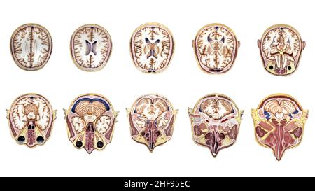 Modèle de tête humaine Banque D'Images