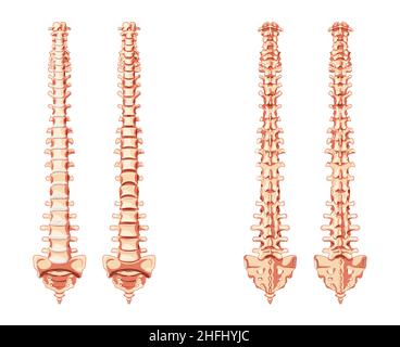 L'anatomie du rachis de la colonne vertébrale humaine avant, arrière avec et sans disque intervertébral.Illustration vectorielle réaliste et plate dans des couleurs naturelles, dos isolé sur fond blanc. Illustration de Vecteur