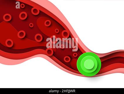 Cholestérol dans le sang, illustration de la coupe de papier vectoriel.Cholestérol élevé, risque de maladie cardiaque et d'accident vasculaire cérébral pour la santé. Illustration de Vecteur