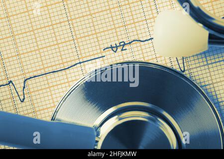 Stéthoscope sur papier avec tracé ECG en gros plan, antécédents médicaux. Banque D'Images