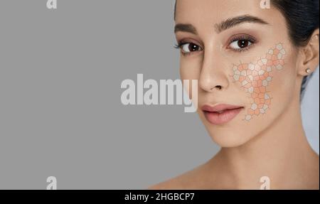 Visage féminin avec problèmes de peau, concept.Peau sèche et irritée sur le visage de la femme Banque D'Images