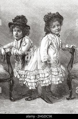 Rosa et Josepha Blazek (1878-1922) étaient des sœurs siamères, connues sous le nom de pygopages, fusionnées au niveau du sacrum et du coccyx, étant opposées dos à dos.Ancienne illustration gravée du 19th siècle de la nature 1884 Banque D'Images