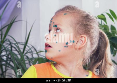 Portrait d'une enfant fille souffrant de la varicelle. Banque D'Images