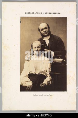 Faradisation du muscle frontal 1854–56, imprimé 1862 Guillaume-Benjamin-Amand Duchenne de Boulogne Français.Faradisation du muscle frontal.Guillaume-Benjamin-Amand Duchenne de Boulogne (français, 1806–1875).1854–56, imprimé en 1862.Impression argentée à partir de négatif en verre.Photographies Banque D'Images