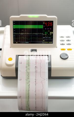 Appareil de cardiographie électronique surveillance des contractions cardiaques fœtales de l'utérus.Impression du rapport de cardiogramme sortie de l'électrocardiogramme dans le travail Banque D'Images
