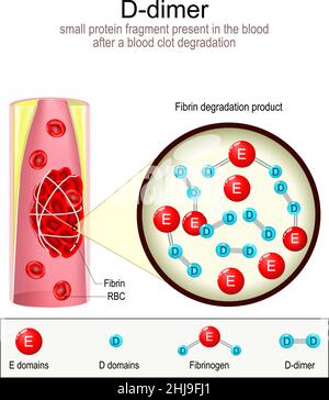 Formation de dimère-D.Vaisseau sanguin avec caillot de sang. Gros plan des produits de dégradation de la fibrine FDP. Indicateur de mauvais pronostic pour COVID-19 Illustration de Vecteur