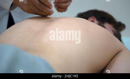 Acupuncture.Gros plan du dos de l'homme avec les aiguilles coincées.Médecine chinoise avec acupuncture.L'homme récupère la santé au masseur professionnel sur le chinois M. Banque D'Images