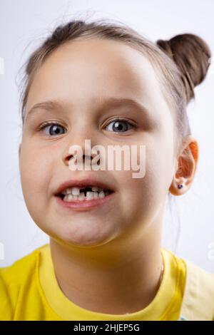 Charmant petit visage de fille avec bouche ouverte montrant la dent de bébé avant manquante dans un t-shirt jaune sur fond blanc.Changement des premières dents.En cours Banque D'Images