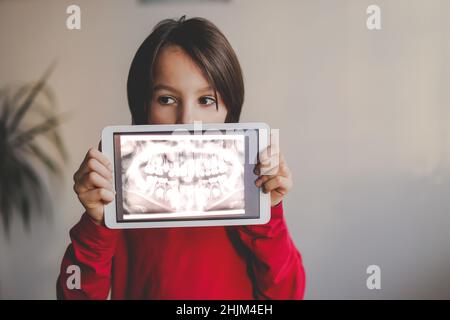 Enfant, portant des bretelles, préadolescent, tenant un comprimé avec une photo de ses dents de rayons X du dentisde lui à la maison Banque D'Images