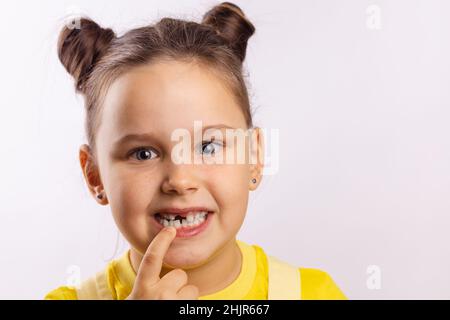 Portrait de jeune fille visage avec la bouche ouverte pointant sur la dent de lait avant manquante avec le doigt regardant l'appareil photo sur fond blanc.Premières dents Banque D'Images