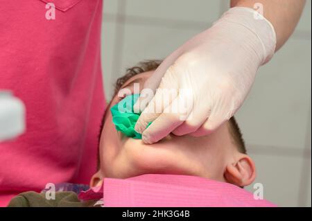 Le dentiste installe un barrage en caoutchouc et une pince pour le traitement d'une dent malade, le garçon est assis dans une chaise dentaire. Banque D'Images