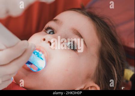 Ultraviolet en dentisterie, le dentiste tient un dispositif à la lumière ultraviolette pour sceller rapidement le remplissage dans la dent de l'enfant, la fille garde sa bouche Banque D'Images