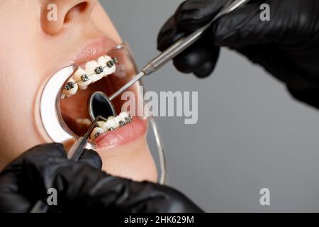 Une jeune femme avec des bretelles métalliques est examinée par un orthodontiste.Correction de la morsure des dents dans la clinique dentaire.Concept de dents saines. Banque D'Images