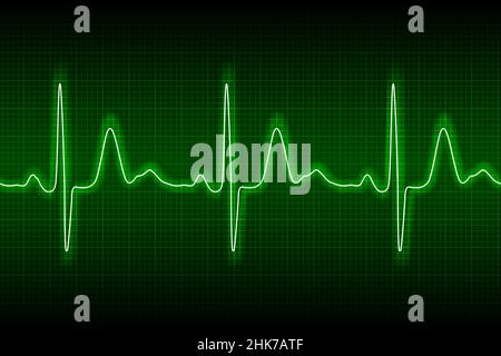 ecg de battements cardiaques ou ligne néon transparente sur fond vert.Diagramme d'électrocardiogramme de la fréquence cardiaque héalsh.Examen de la santé humaine.Médicaments tes Illustration de Vecteur