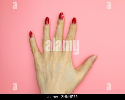 Vernis à ongles peeling.Main de fille avec vernis à ongles rouge sans manucure vue de dessus.Les mains ne sont pas bien entretenues sur fond rose. Banque D'Images