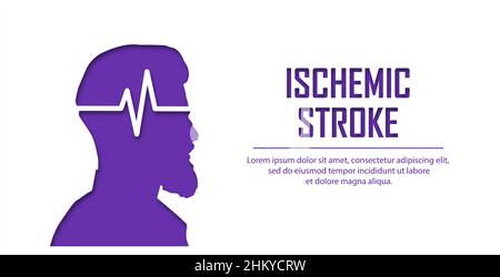 Personnes souffrant d'accident ischémique cérébral.Notion : accident ischémique cérébral du patient.Aide médicale.Silhouette de gens dans un style coupé en papier.Affiche types de traits, banne Illustration de Vecteur