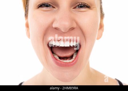 une femme hurle émotionnellement avec sa bouche largement ouverte, image de profil sur un fond blanc. Banque D'Images