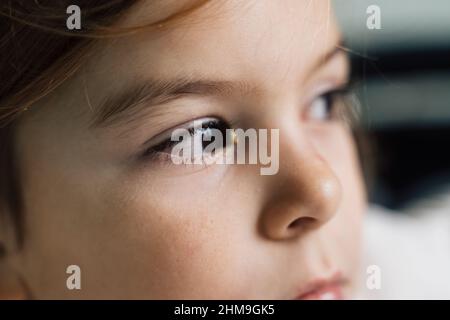 Gros plan de l'enfant malade avec conjonctivite, yeux rouges avec pus Banque D'Images