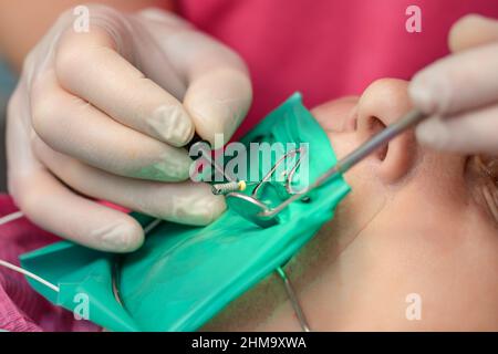 Une patiente avec un écarteur de joue avec un cercueil vert dans une clinique dentaire, un dentiste en gants de latex examine ses dents avec un bore et un miroir, a Banque D'Images