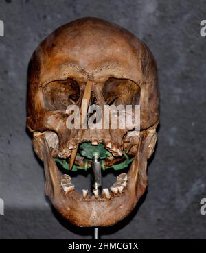 Crâne d'un guerrier viking qui est mort au combat avec la pointe de la lance qui l'a tué, Musée national du Danemark (Nationalmuseet) Banque D'Images