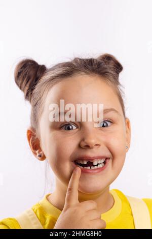 Belle femme enfant avec bouche ouverte montrant la dent de lait avant manquante avec le doigt sur la lèvre inférieure souriant excitement sur fond blanc. Premières dents Banque D'Images